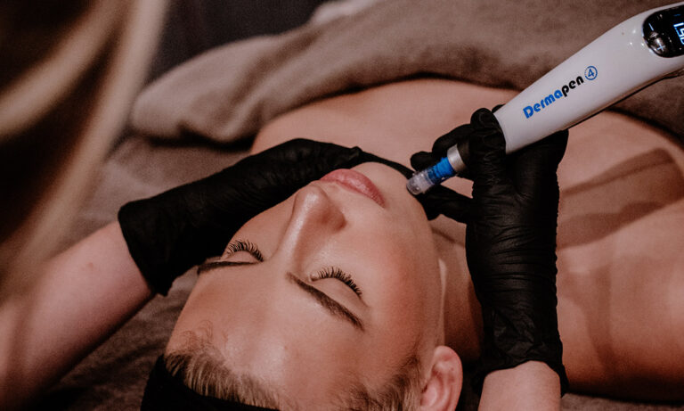 Microneedling behandeling bij Mudita Beauty voor huidvernieuwing in de diepte